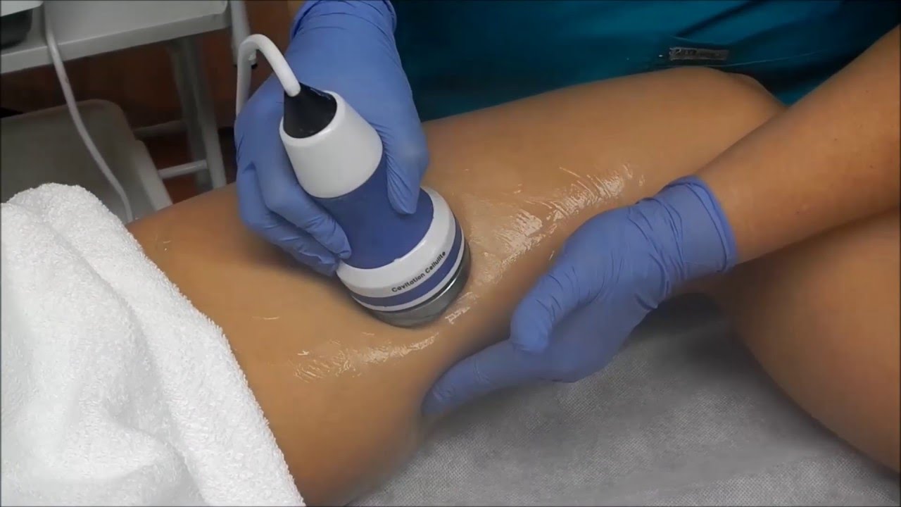 Cellulite Treatment – Good Understanding Related To Two Types Of Procedure